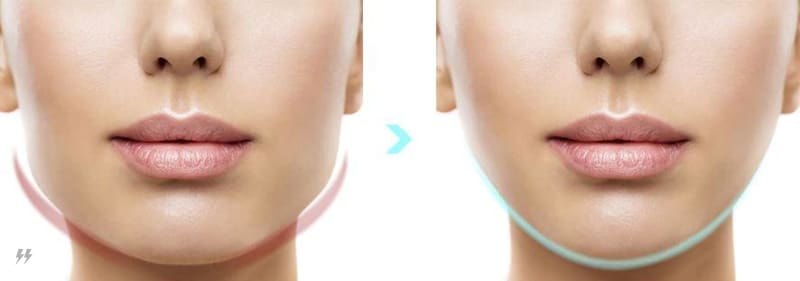 Massageador Facial Lifting Modelador V-Face Energyplus Cuidado 011